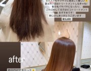 ダレノガレ明美さんにピコトリートメントをご紹介いただきましたのイメージ